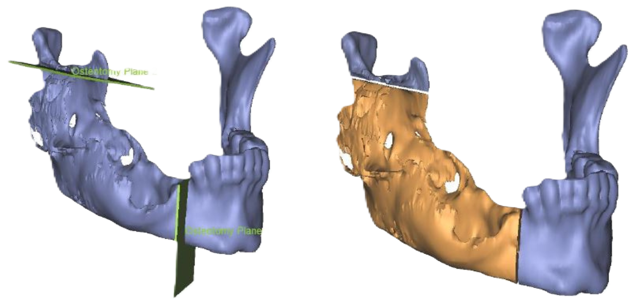 Digital skull visualization